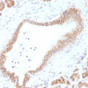 FFPE human pancreas sections stained with 100 ul anti-Beta Catenin (clone CTNNB1/1507) at 1:50. HIER epitope retrieval prior to staining was performed in 10mM Tris 1mM EDTA, pH 9.0.